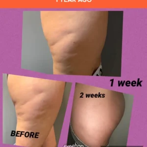 Body Boost Before & After